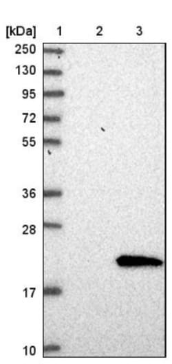 ANKRD37 Antibody, Novus Biologicals 25 &mu;L | Buy Online | Novus Biologicals | Fisher Scientific