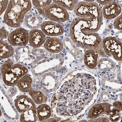ANKRD40 Antibody, Novus Biologicals 0.1mL; Unlabeled:Antibodies, Polyclonal