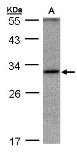 ANKRD45 Antibody, Novus Biologicals 0.1mg; Unlabeled:Antibodies, Polyclonal