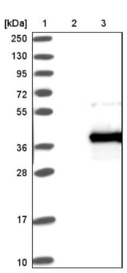 ANKRD45 Antibody, Novus Biologicals:Antibodies:Primary Antibodies