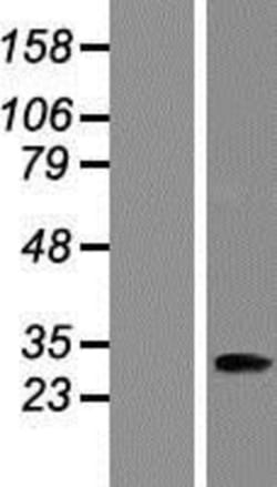 Novus Biologicals&trade;&nbsp;ANKRD45 Overexpression Lysate
