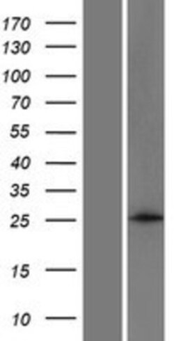 Novus Biologicals&trade;&nbsp;ANKRD46 Overexpression Lysate