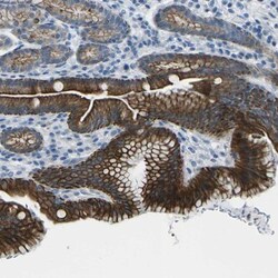 ANKRD46 Antibody, Novus Biologicals 0.1mL; Unlabeled:Antibodies, Polyclonal
