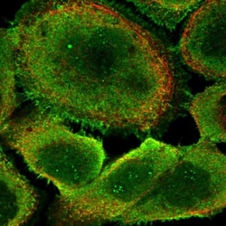 ANKRD5 Antibody, Novus Biologicals 25ul | Buy Online | Novus Biologicals | Fisher Scientific