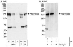 ANKRD50 Antibody, Novus Biologicals 0.1mg; Unlabeled:Antibodies, Polyclonal
