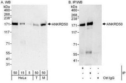 ANKRD50 Antibody, Novus Biologicals 0.1mg; Unlabeled:Antibodies, Polyclonal
