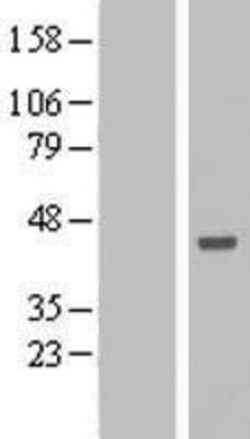 Novus Biologicals&trade;&nbsp;ANKRD53 Overexpression Lysate