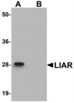 Novus Biologicals&trade;&nbsp;ANKRD54 Antibody Blocking Peptide