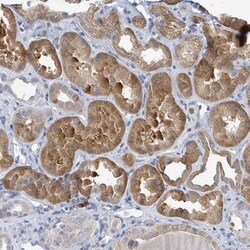 ANKRD55 Antibody, Novus Biologicals 0.1mL; Unlabeled:Antibodies, Polyclonal