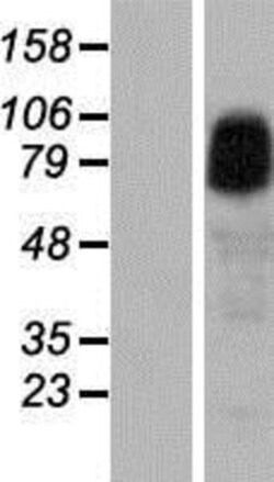 Novus Biologicals™ ANKRD6 Overexpression Lysate