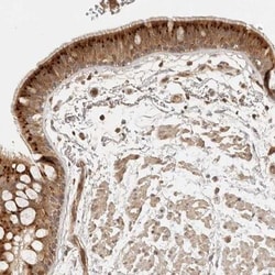 ANKRD61 Antibody, Novus Biologicals 25 &mu;L; Unlabeled:Antibodies, Polyclonal
