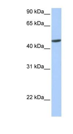 ANKRD65 Antibody, Novus Biologicals:Antibodies:Primary Antibodies