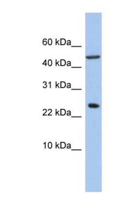 ANKRD7 Antibody, Novus Biologicals 100&mu;L; Unlabeled:Antibodies, Polyclonal