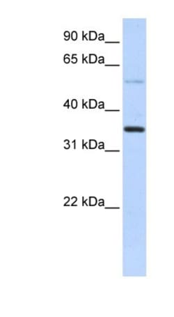 ANKRD9 Antibody, Novus Biologicals 100 &mu;L | Buy Online | Novus Biologicals | Fisher Scientific