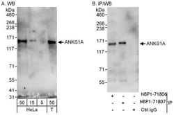 ANKS1A Antibody, Novus Biologicals 0.1mg; Unlabeled:Antibodies, Polyclonal