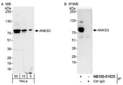 ANKS3 Antibody, Novus Biologicals 0.1 mL | Buy Online | Novus Biologicals | Fisher Scientific
