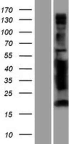 Novus Biologicals&trade;&nbsp;ANKS4B Overexpression Lysate