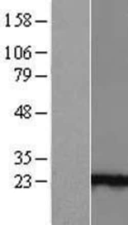 Novus Biologicals™ Ankyrin repeat domain 39 Overexpression Lysate