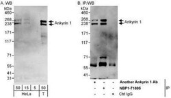 Ankyrin 1 Antibody, Novus Biologicals 0.1mg; Unlabeled:Antibodies, Polyclonal
