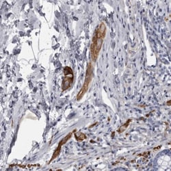 Ankyrin Brain Antibody, Novus Biologicals 0.1mL; Unlabeled:Antibodies,