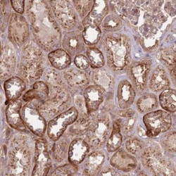 Ankyrin Repeat Domain 24 Antibody, Novus Biologicals:Antibodies:Primary