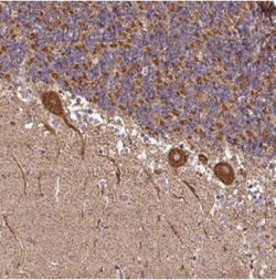 Ankyrin Repeat Domain 33B Antibody, Novus Biologicals 25 &mu;L, Unlabeled:Antibodies,