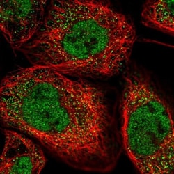 Ankyrin repeat domain 39 Antibody, Novus Biologicals:Antibodies:Primary