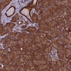 Ankyrin repeat domain 39 Antibody, Novus Biologicals:Antibodies:Primary