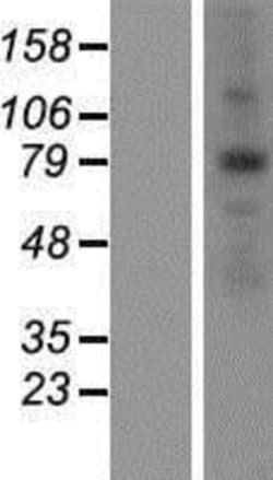 Novus Biologicals&trade;&nbsp;ANKZF1 Overexpression Lysate