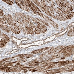 ANKZF1 Antibody, Novus Biologicals:Antibodies:Primary Antibodies