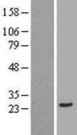 Novus Biologicals&trade;&nbsp;Annexin 2 Receptor Overexpression Lysate