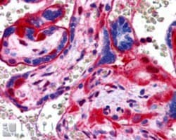 Annexin A11 Antibody, Novus Biologicals 0.1mg; Unlabeled:Antikörper