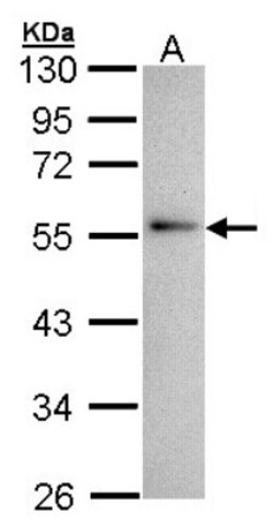 Annexin A11 Antibody, Novus Biologicals 0.1mL; Unlabeled:Antibodies, Polyclonal
