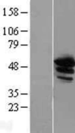 Novus Biologicals&trade;&nbsp;Annexin A11 Overexpression Lysate