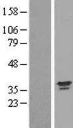 Novus Biologicals™ Annexin A13 Overexpression Lysate