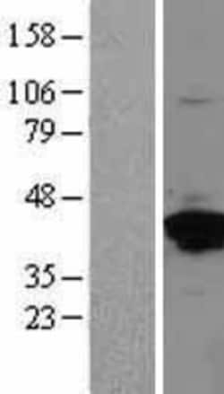 Novus Biologicals&trade;&nbsp;Annexin A2 Overexpression Lysate