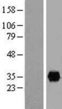 Novus Biologicals&trade;&nbsp;Annexin A4 Overexpression Lysate