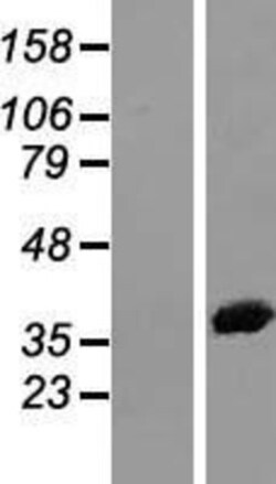 Novus Biologicals&trade;&nbsp;Annexin A2 Overexpression Lysate