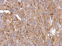 Annexin A3 Antibody, Novus Biologicals 0.1mL; Unlabeled:Antibodies, Polyclonal