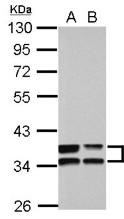 Annexin A3 Antibody, Novus Biologicals 0.1mL; Unlabeled:Antibodies, Polyclonal
