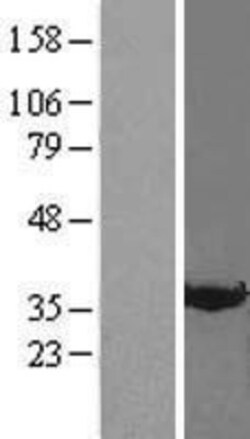 Novus Biologicals&trade;&nbsp;Annexin A3 Overexpression Lysate