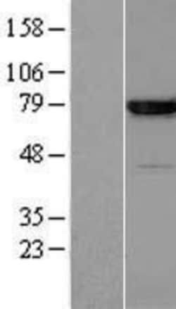 Novus Biologicals™ Annexin A6 Overexpression Lysate
