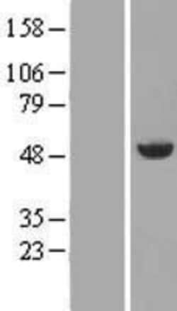 Novus Biologicals™ Annexin A7 Overexpression Lysate