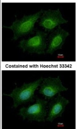Annexin A8/ANXA8 Antibody, Novus Biologicals 0.1mL; Unlabeled:Antibodies,