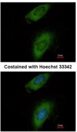 Annexin A8/ANXA8 Antibody, Novus Biologicals 0.1mL; Unlabeled:Antibodies,