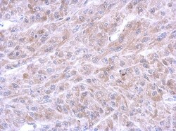 Annexin A8/ANXA8 Antibody, Novus Biologicals 0.1mL; Unlabeled:Antibodies,