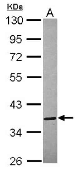 Annexin A8/ANXA8 Antibody, Novus Biologicals 0.1mL; Unlabeled:Antibodies,