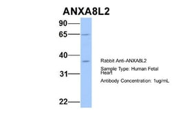 Annexin A8 like2 Antibody, Novus Biologicals 100&mu;L; Unlabeled:Antibodies,