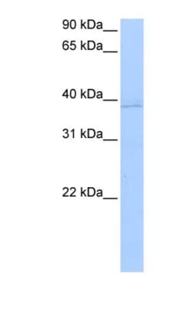 Annexin A8 like2 Antibody, Novus Biologicals:Antibodies:Primary Antibodies