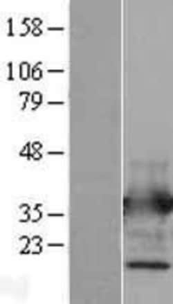Novus Biologicals&trade;&nbsp;Annexin V Overexpression Lysate